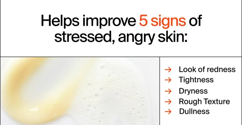 Help improve 5 signs of stressed, angry skin