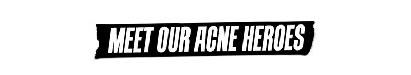 MEET OUR ACNE HEROS
