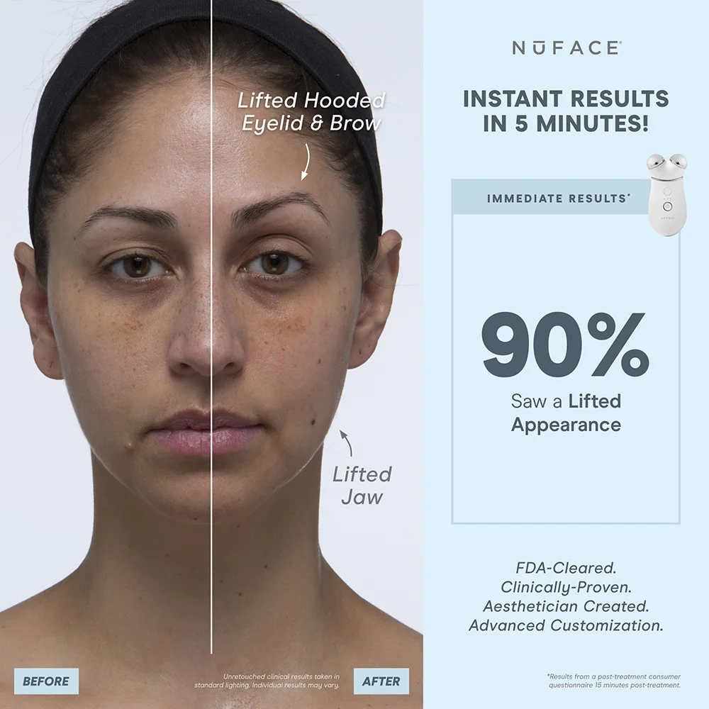 Before and after showcasing a toned neck and toned chin after long term use of the new Smart Devices.