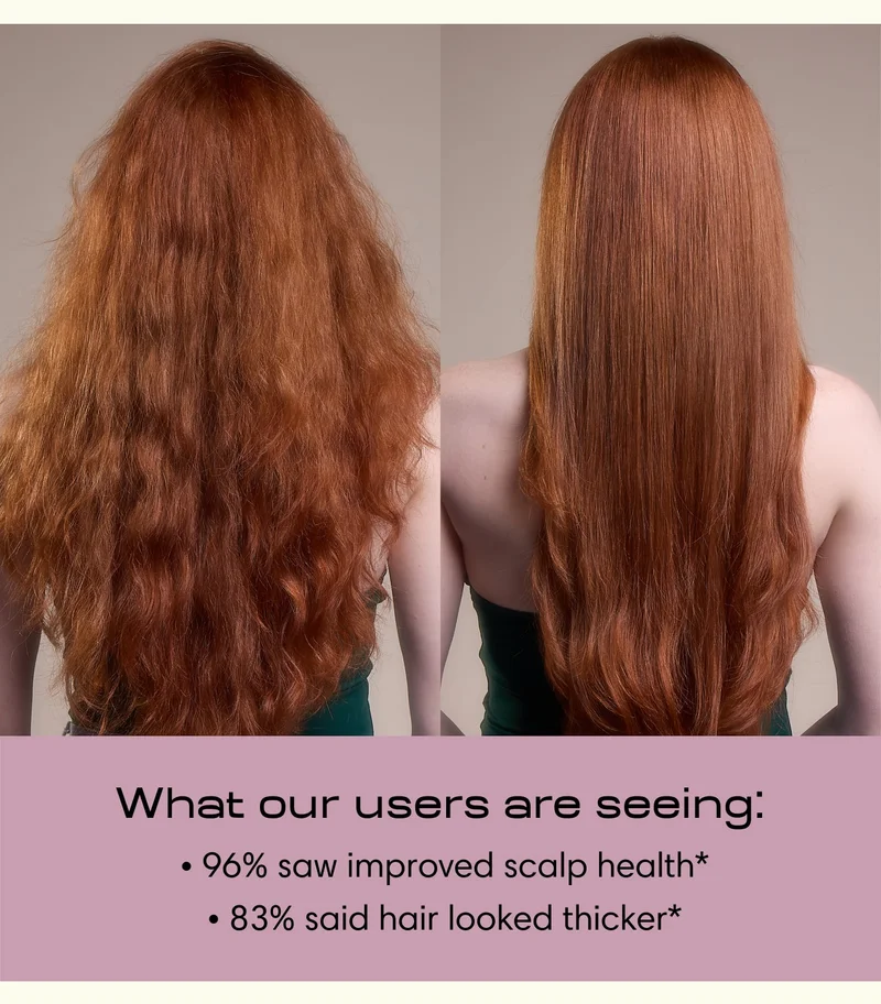 What our users are seeing: &nbsp;• 96% saw improved scalp health*  • 83% said hair looked thicker*
