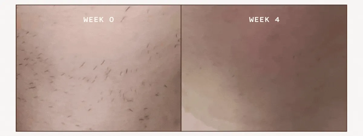 Real Results From Real Women