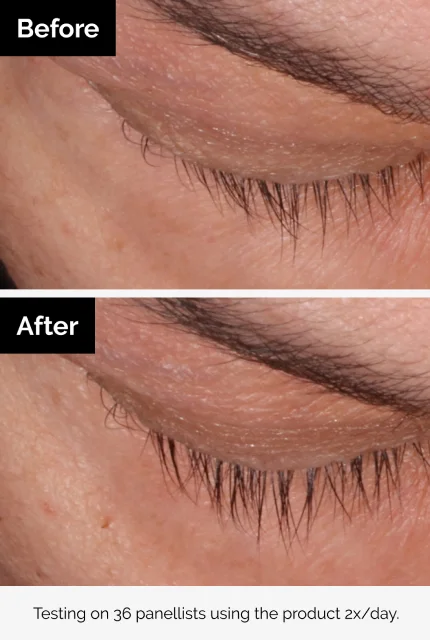 Before & After Results.