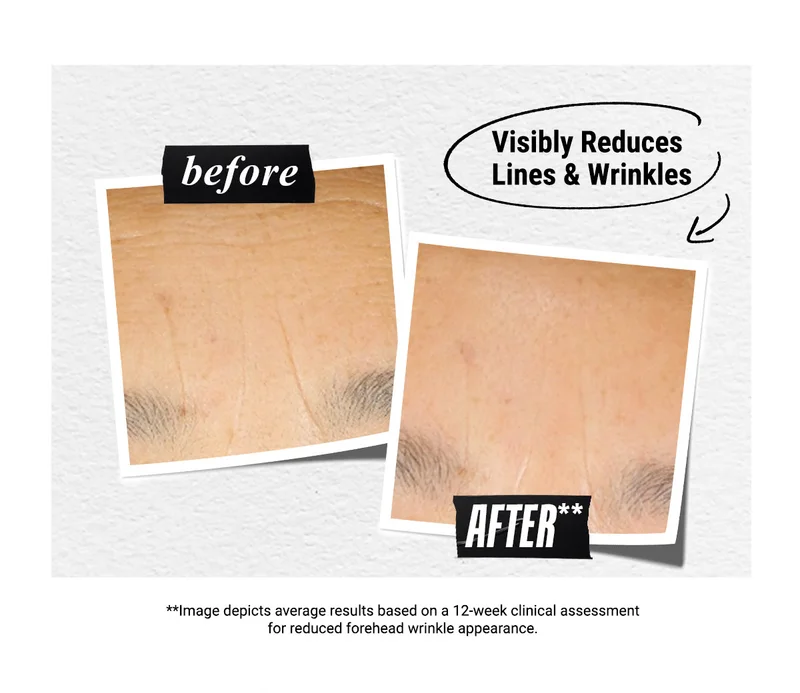 Visibly Reduces Lines & Wrinkles