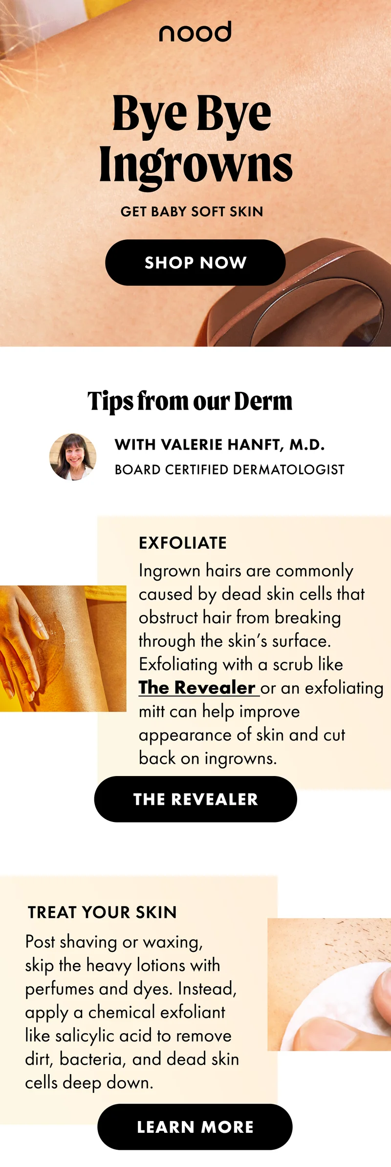 Bye, Bye Ingrown Hairs. Get Baby Soft Skin. Shop Now. Tips from our Derm with Valerie Hanft, M.D. Exfoliate with a scrib like The Revealer. Learn more.