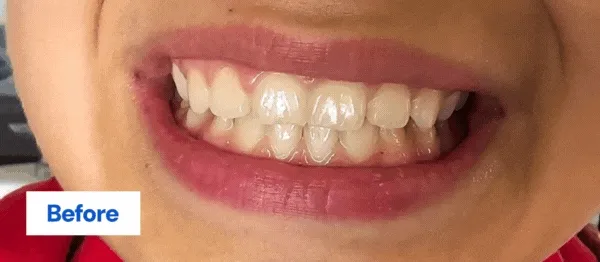 Before & After