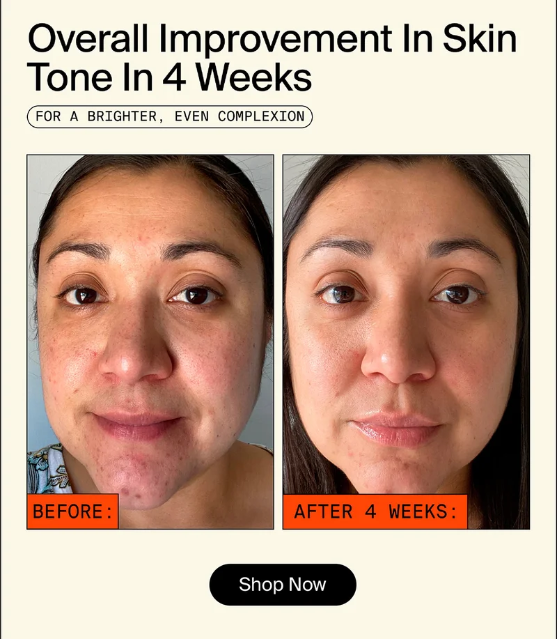 Brighter, even complexion