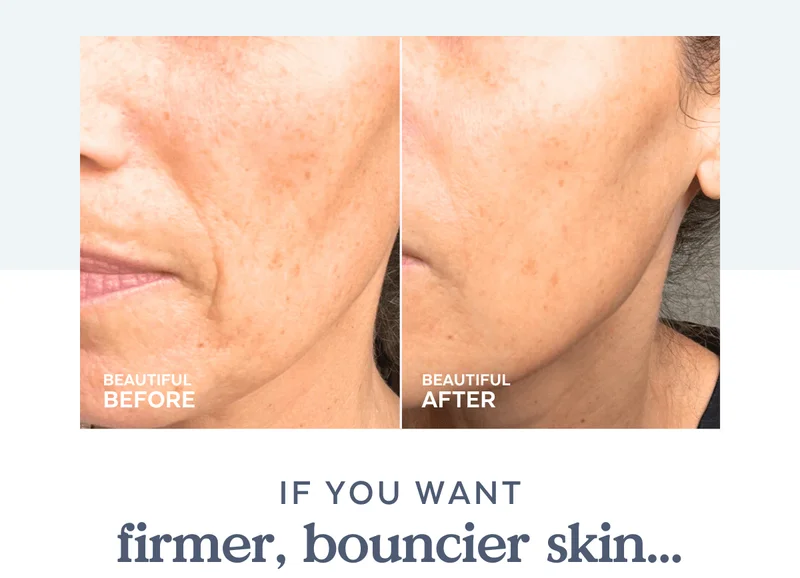 If you want firmer, bouncier skin...