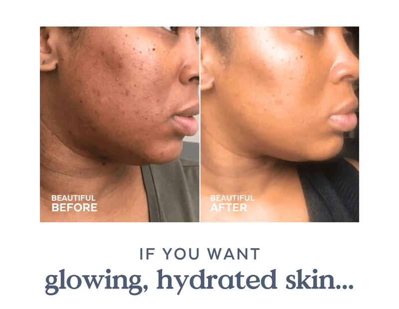 If you want glowing, hydrated skin...