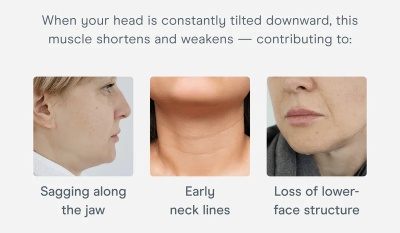 When your head is constantly tilted downward, this muscle shortens and weakens — contributing to: Sagging along the jaw. Early neck lines. Loss of lower-face structure.