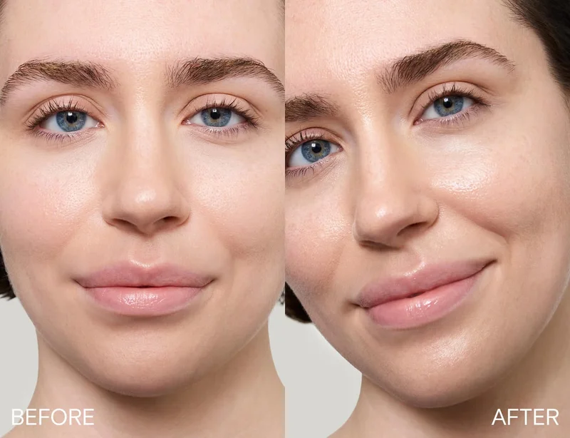 Before/after