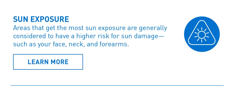 SUN EXPOSURE