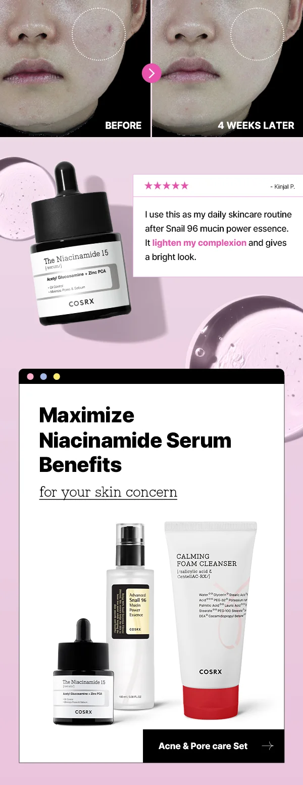 niacinamide serum benefits for your skin concern