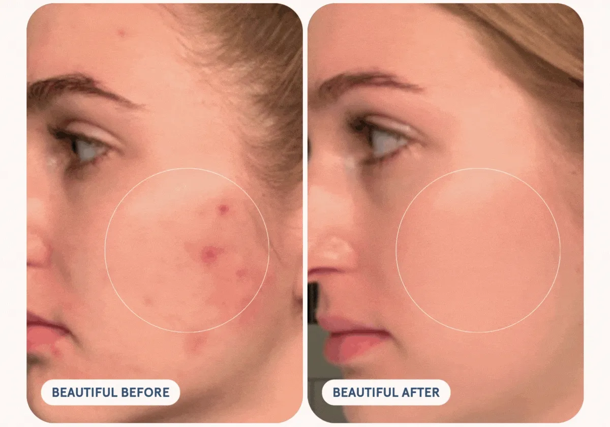 Beautiful Before & After
