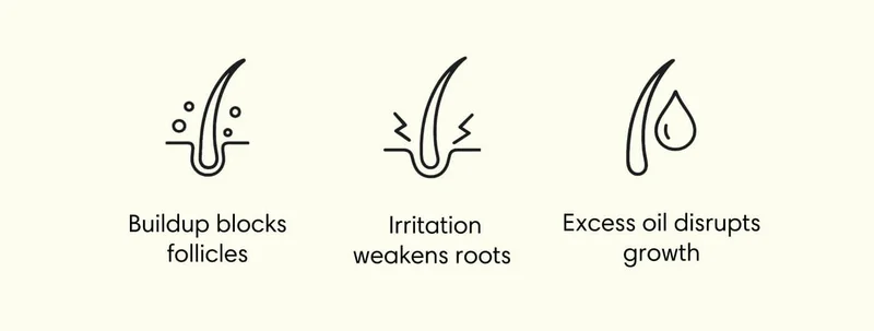 Buildup blocks follicles | &nbsp;Irritation weakens roots | Excess oil disrupts growth
