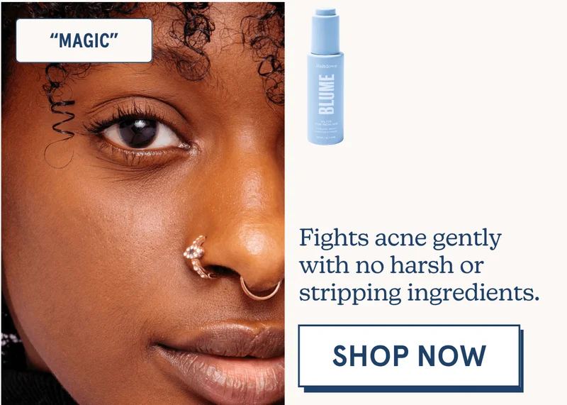 Fights acne gently with no harsh or stripping ingredients. [SHOP NOW]