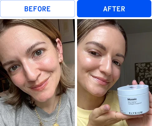 Before | After