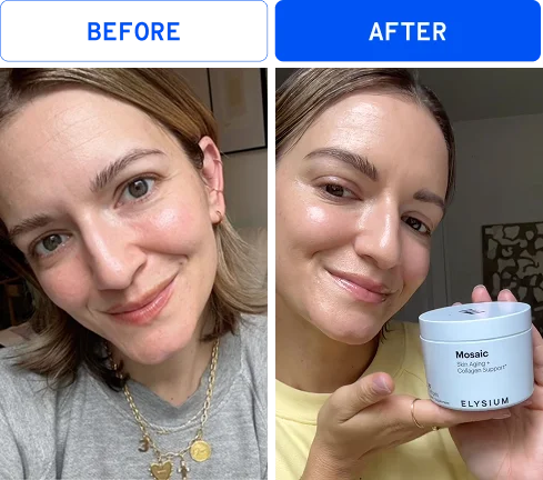 Before | After