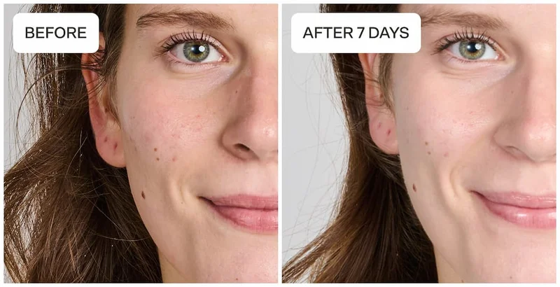 [B&A IMAGE- GREEN]