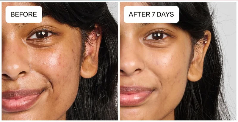 [B&A IMAGE- ORANGE]