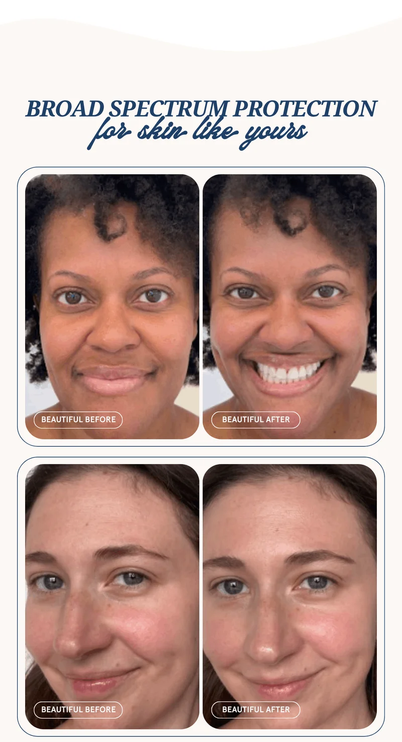 Broad spectrum protection for skin like yours