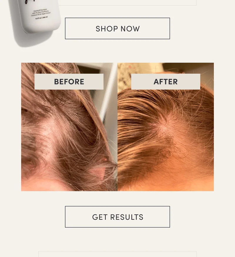 Shop now | Before | After | Get results