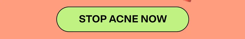 STOP ACNE NOW