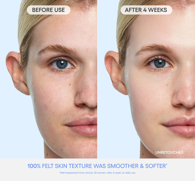 Water Bank Aqua Facial