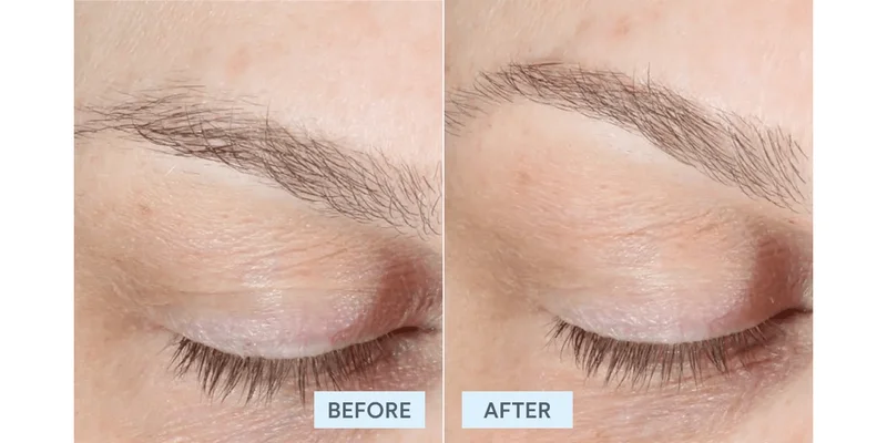 Before & After
