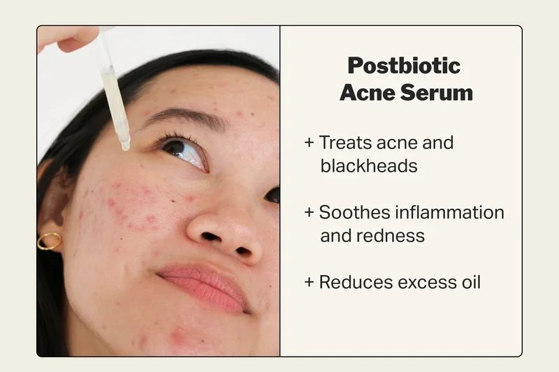 Postbiotic  Acne Serum