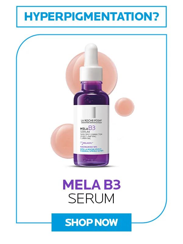 Hyperpigmentation