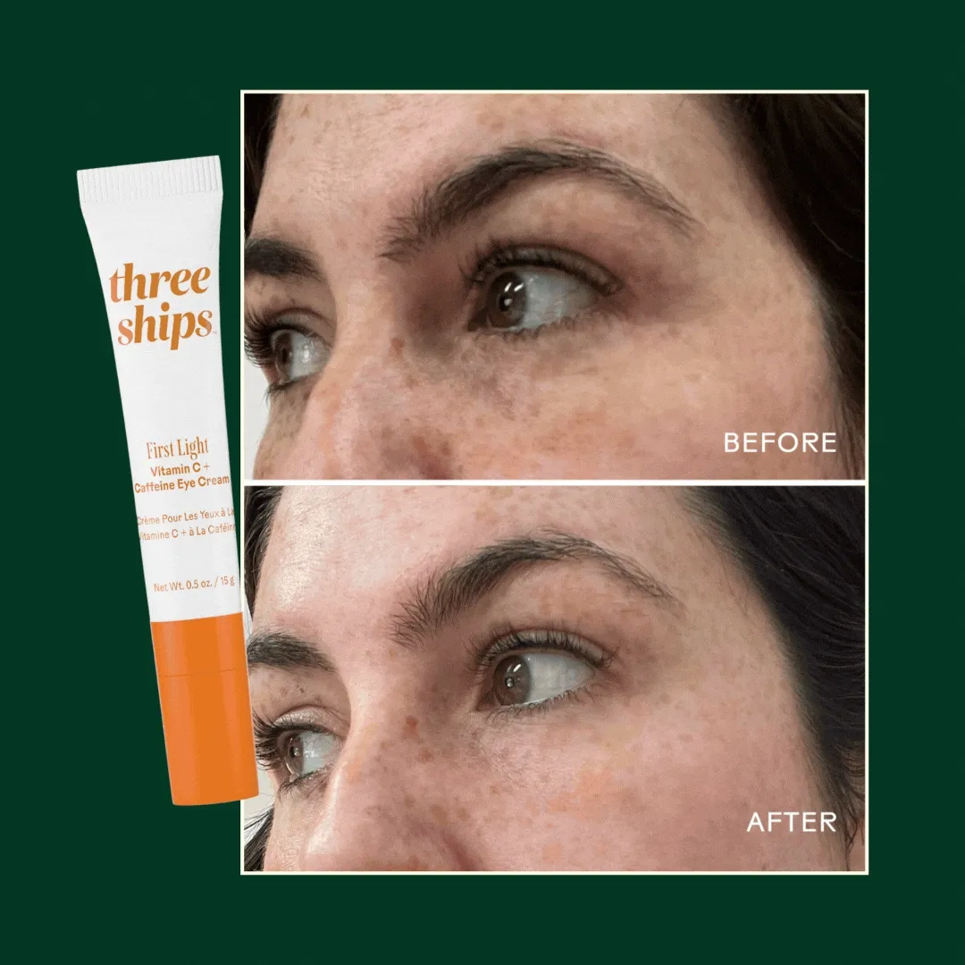 Customer before & after images