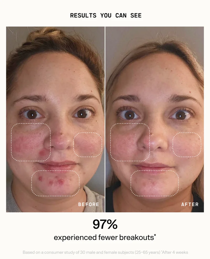 Results-You-Can-See