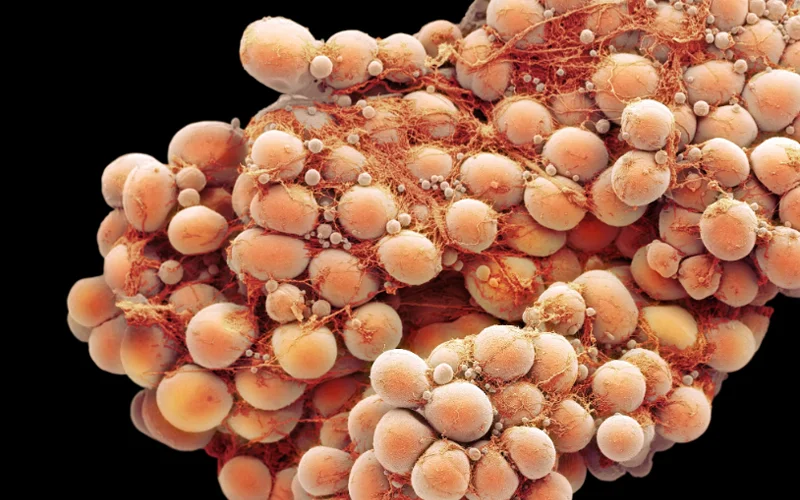 A colored scanning electron micrograph shows clusters of fat-storing cells, or adipocytes.