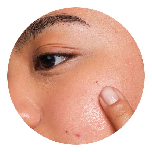 Help reduce the look of skin redness.