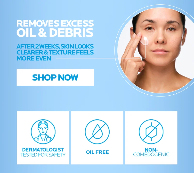 Removes Excess Oil and Debris