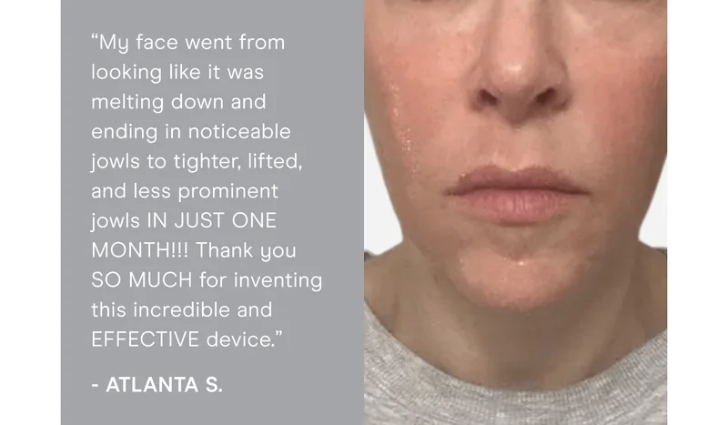 “My face went from looking like it was melting down and ending in noticeable jowls to tighter, lifted, and less prominent jowls IN JUST ONE MONTH!!! Thank you SO MUCH for inventing this incredible and EFFECTIVE device.” - Atlanta S.