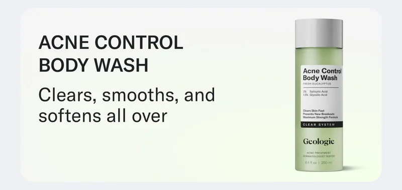 Acne Control Body Wash