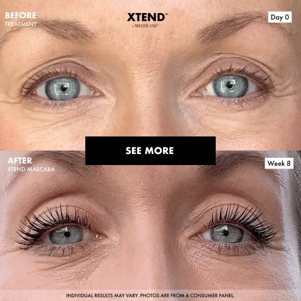 Before and After with XTend