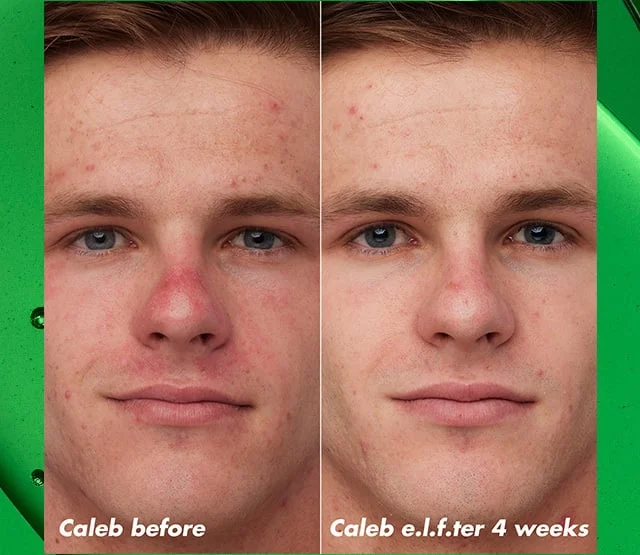 Before & e.l.f.ter of PLZ Clarify Facial Oil