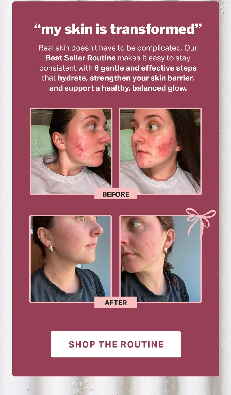 “my skin is transformed” | SHOP THE ROUTINE