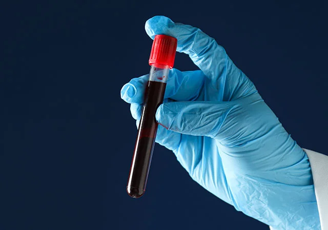 A hand in a blue surgical glove holds a vial of blood.