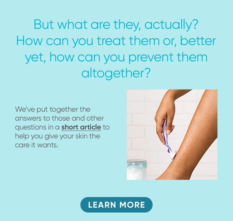 But what are they, actually? How can you treat them or, better yet, how can you prevent them altogether? We'we put together the answers to those and other questions in a short article to help you give your skin the care it wants. LEARN MORE