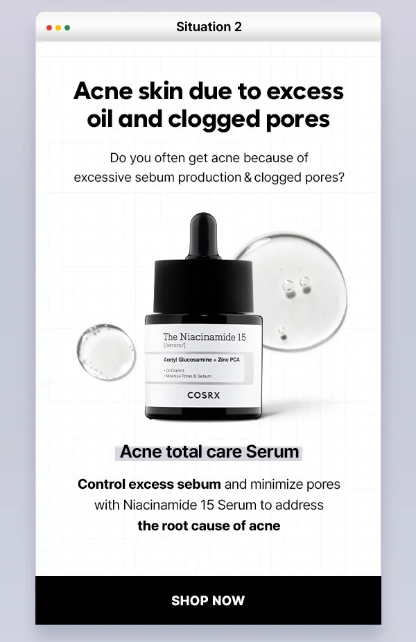acne skin due to excess oil Niacinamide serum