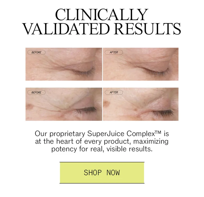 Anti-Wrinkle Retinol Overnight Serum Clinically Validated Results