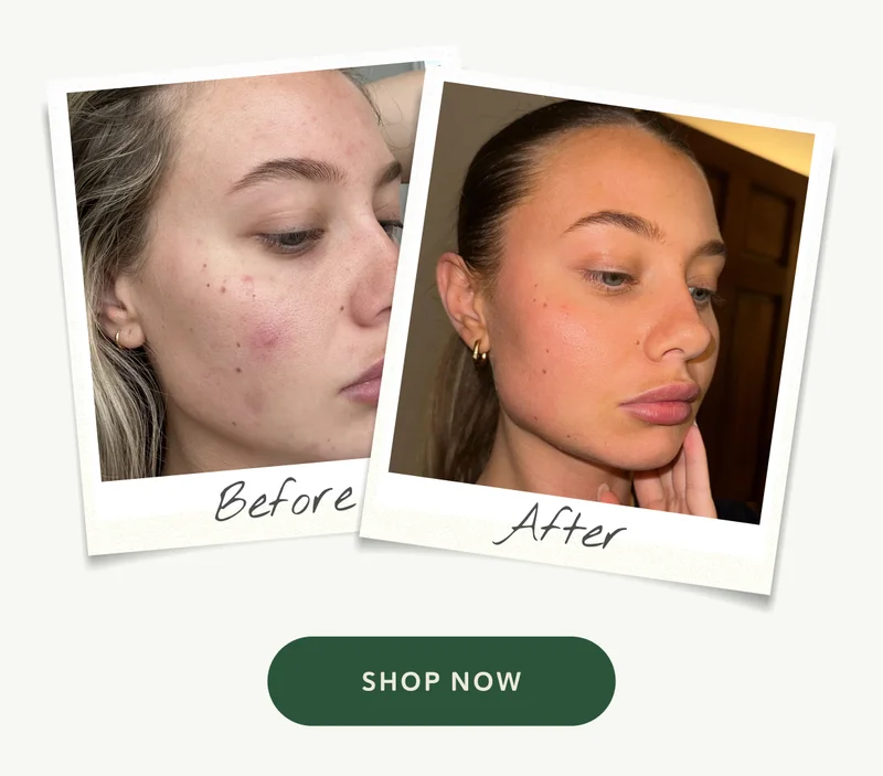 Before and After