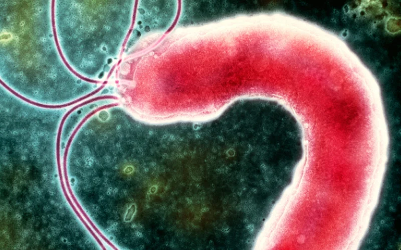 Colored transmission electron micrograph of a single Helicobacter pylori bacterium
