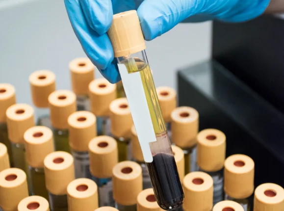 An image of test tubes