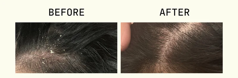 BEFORE | AFTER
