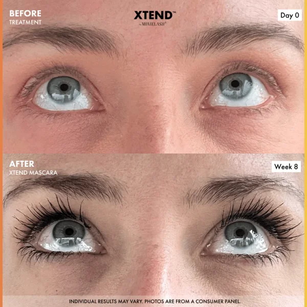 Before and After