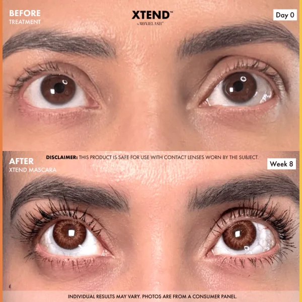 Before and After